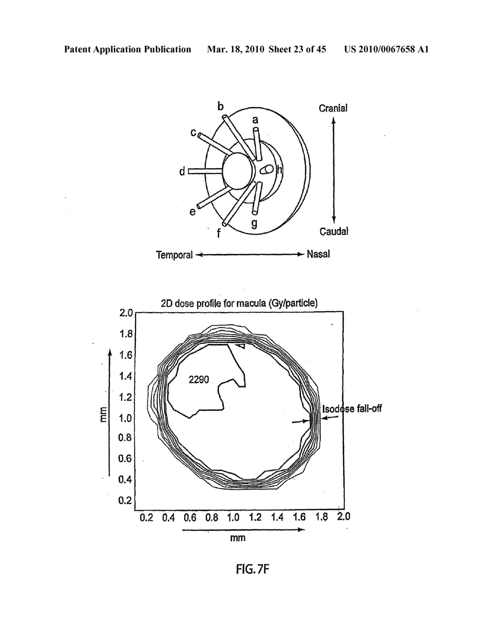 ORTHOVOLTAGE RADIOTHERAPY - diagram, schematic, and image 24