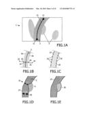 METHOD AND DEVICE FOR IMAGING A BLOOD VESSEL diagram and image