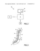 METHOD AND DEVICE FOR IMAGING A BLOOD VESSEL diagram and image