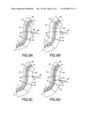 METHOD AND DEVICE FOR IMAGING A BLOOD VESSEL diagram and image