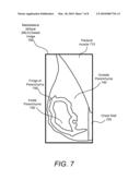 COMPUTER-AIDED DETECTION AND CLASSIFICATION OF SUSPICIOUS MASSES IN BREAST IMAGERY diagram and image