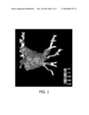 REGISTRATION OF ELECTROANATOMICAL MAPPING POINTS TO CORRESPONDING IMAGE DATA diagram and image