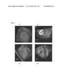 Method and System for Physiological Image Registration and Fusion diagram and image