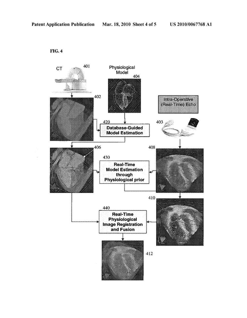 Method and System for Physiological Image Registration and Fusion - diagram, schematic, and image 05