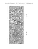 METHODS OF CHROMOGEN SEPARATION-BASED IMAGE ANALYSIS diagram and image