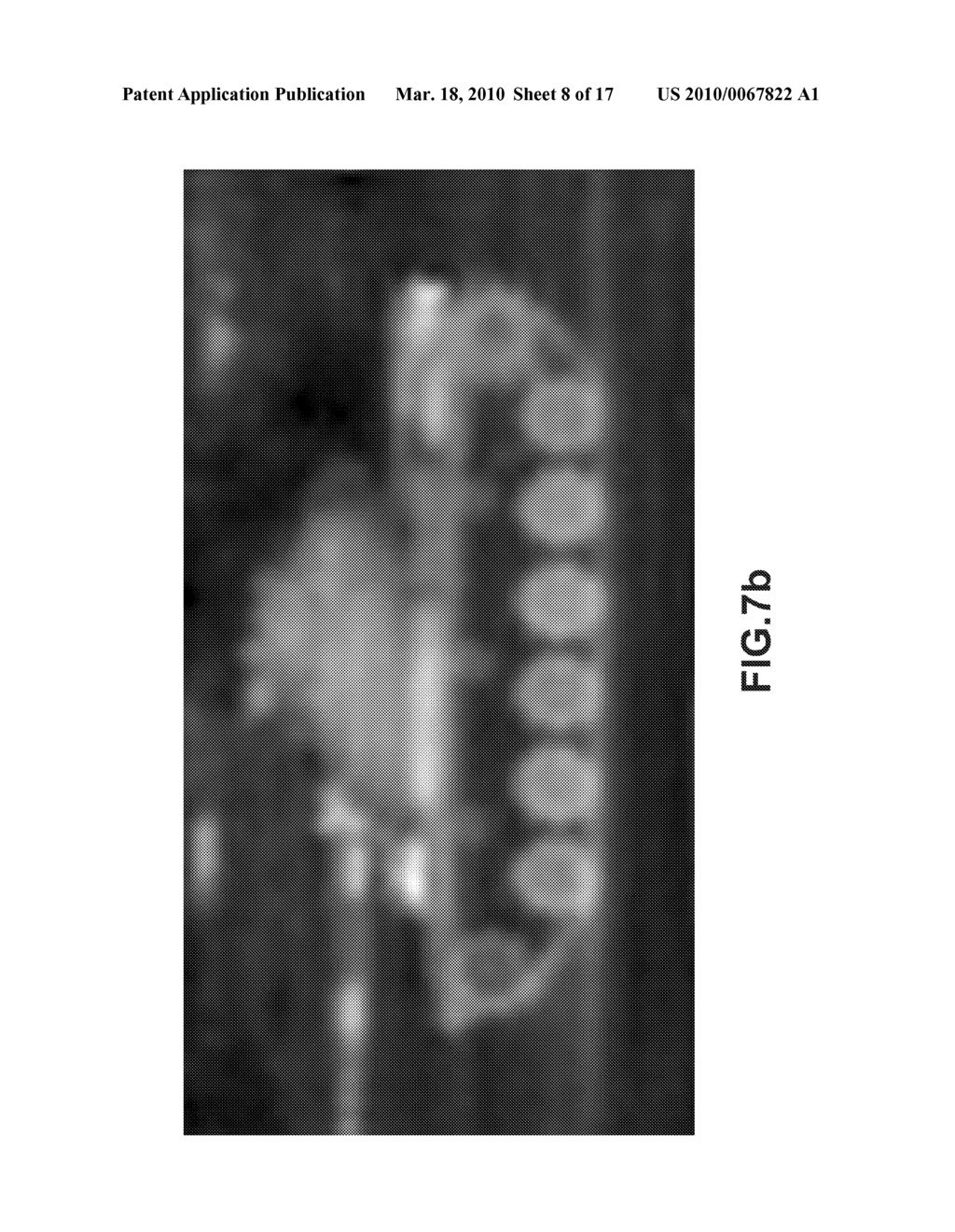 SYSTEM AND METHOD OF SUPER-RESOLUTION IMAGING FROM A SEQUENCE OF TRANSLATED AND ROTATED LOW-RESOLUTION IMAGES - diagram, schematic, and image 09