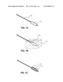 LOCAL DELIVERY OF WATER-SOLUBLE OR WATER-INSOLUBLE THERAPEUTIC AGENTS TO THE SURFACE OF BODY LUMENS diagram and image