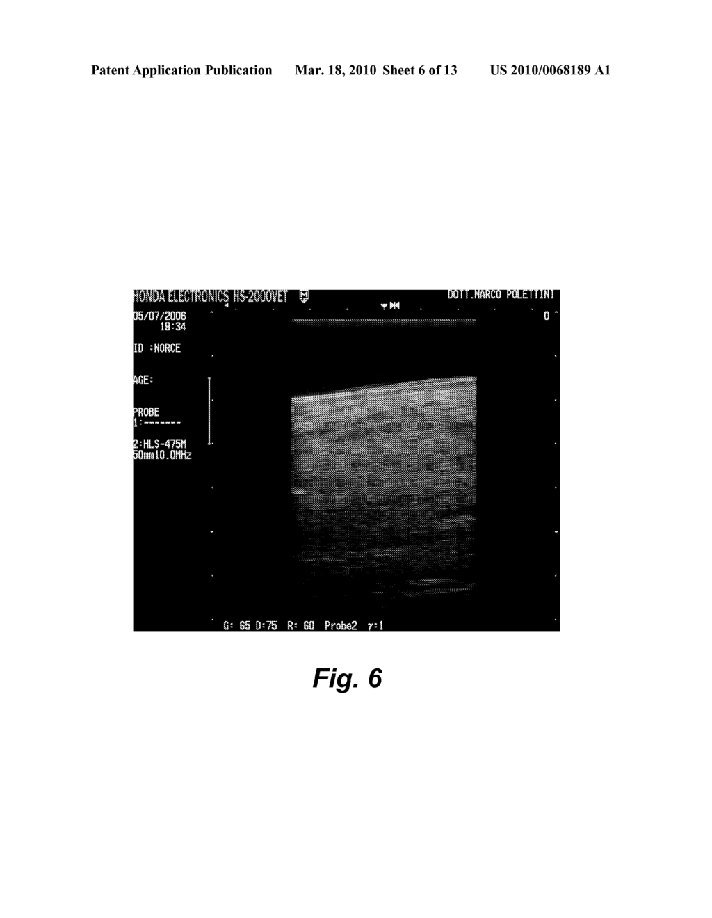 Method for Expanding Adult Stem Cells from Blood and Compositions and Methods for Using the Same - diagram, schematic, and image 07