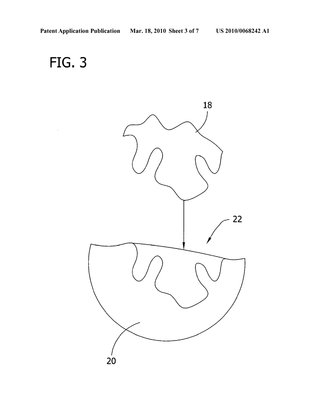 Medical Devices for Localized Drug Delivery - diagram, schematic, and image 04