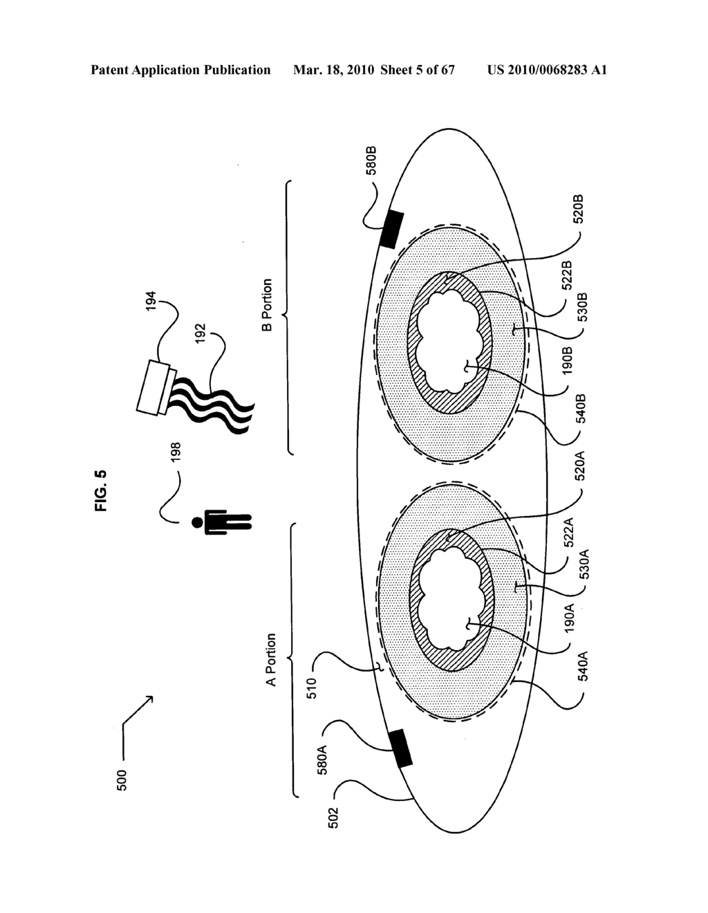 Ex VIVO modifiable particle or polymeric material medicament carrier - diagram, schematic, and image 06