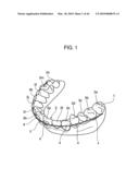 ORTHODONTIC APPLIANCE diagram and image