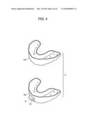 ORTHODONTIC APPLIANCE diagram and image