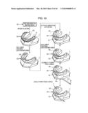 ORTHODONTIC APPLIANCE diagram and image