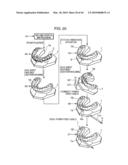 ORTHODONTIC APPLIANCE diagram and image