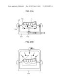 ORTHODONTIC APPLIANCE diagram and image