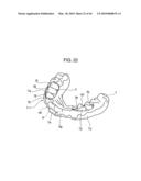 ORTHODONTIC APPLIANCE diagram and image