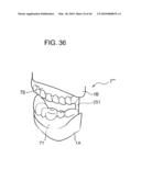 ORTHODONTIC APPLIANCE diagram and image