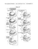 ORTHODONTIC APPLIANCE diagram and image