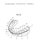 ORTHODONTIC APPLIANCE diagram and image