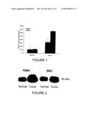 Use of N-Myristoyltransferase on Non-Tumor Tissue for Cancer Diagnosis diagram and image