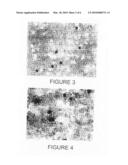 Use of N-Myristoyltransferase on Non-Tumor Tissue for Cancer Diagnosis diagram and image