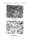Use of N-Myristoyltransferase on Non-Tumor Tissue for Cancer Diagnosis diagram and image