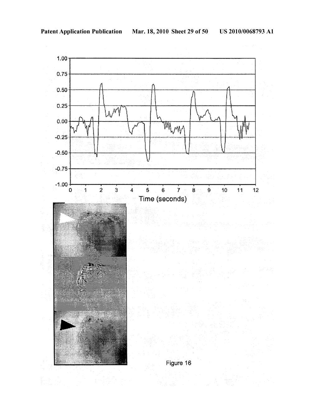 DEVICES AND METHODS FOR PRODUCTION OF CELL AGGREGATES - diagram, schematic, and image 30