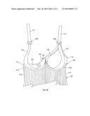 Nursing Garment and Method of Making diagram and image