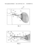 Tennis Training Aid diagram and image