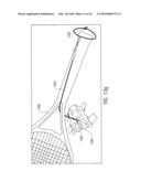 Tennis Training Aid diagram and image