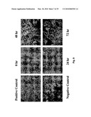 METHODS OF TREATING BONE DISEASE USING VASCULAR ENDOTHELIAL GROWTH FACTOR FUSION CONSTRUCTS diagram and image