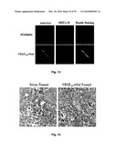 METHODS OF TREATING BONE DISEASE USING VASCULAR ENDOTHELIAL GROWTH FACTOR FUSION CONSTRUCTS diagram and image