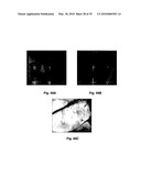 METHODS OF TREATING BONE DISEASE USING VASCULAR ENDOTHELIAL GROWTH FACTOR FUSION CONSTRUCTS diagram and image