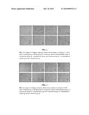 Pharmaceutical composition for treatment of chronic liver diseases and use thereof diagram and image