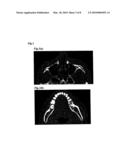 BONE MODEL, BONE FILLER AND PROCESS FOR PRODUCING BONE FILLER diagram and image