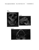 BONE MODEL, BONE FILLER AND PROCESS FOR PRODUCING BONE FILLER diagram and image