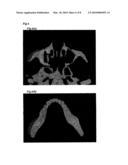 BONE MODEL, BONE FILLER AND PROCESS FOR PRODUCING BONE FILLER diagram and image