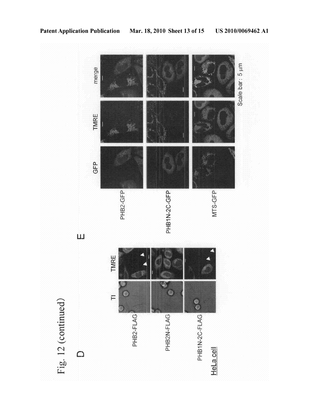 MITOCHONDRIAL FUNCTION OF PROHIBITIN 2 (PHB2) - diagram, schematic, and image 14