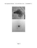 Radioactive Material Sequestration diagram and image