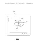 PATIENT MONITOR INCLUDING MULTI-PARAMETER GRAPHICAL DISPLAY diagram and image