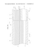 CATHETER WITH FLEXIBLE PRE-SHAPED TIP SECTION diagram and image