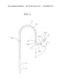 CATHETER WITH FLEXIBLE PRE-SHAPED TIP SECTION diagram and image