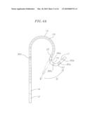 CATHETER WITH FLEXIBLE PRE-SHAPED TIP SECTION diagram and image