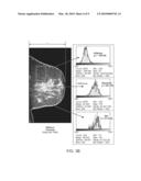 Systems and Methods for Tracking and Targeting Object in a Patient Using Imaging Techniques diagram and image