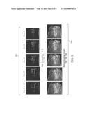 Systems and Methods for Tracking and Targeting Object in a Patient Using Imaging Techniques diagram and image