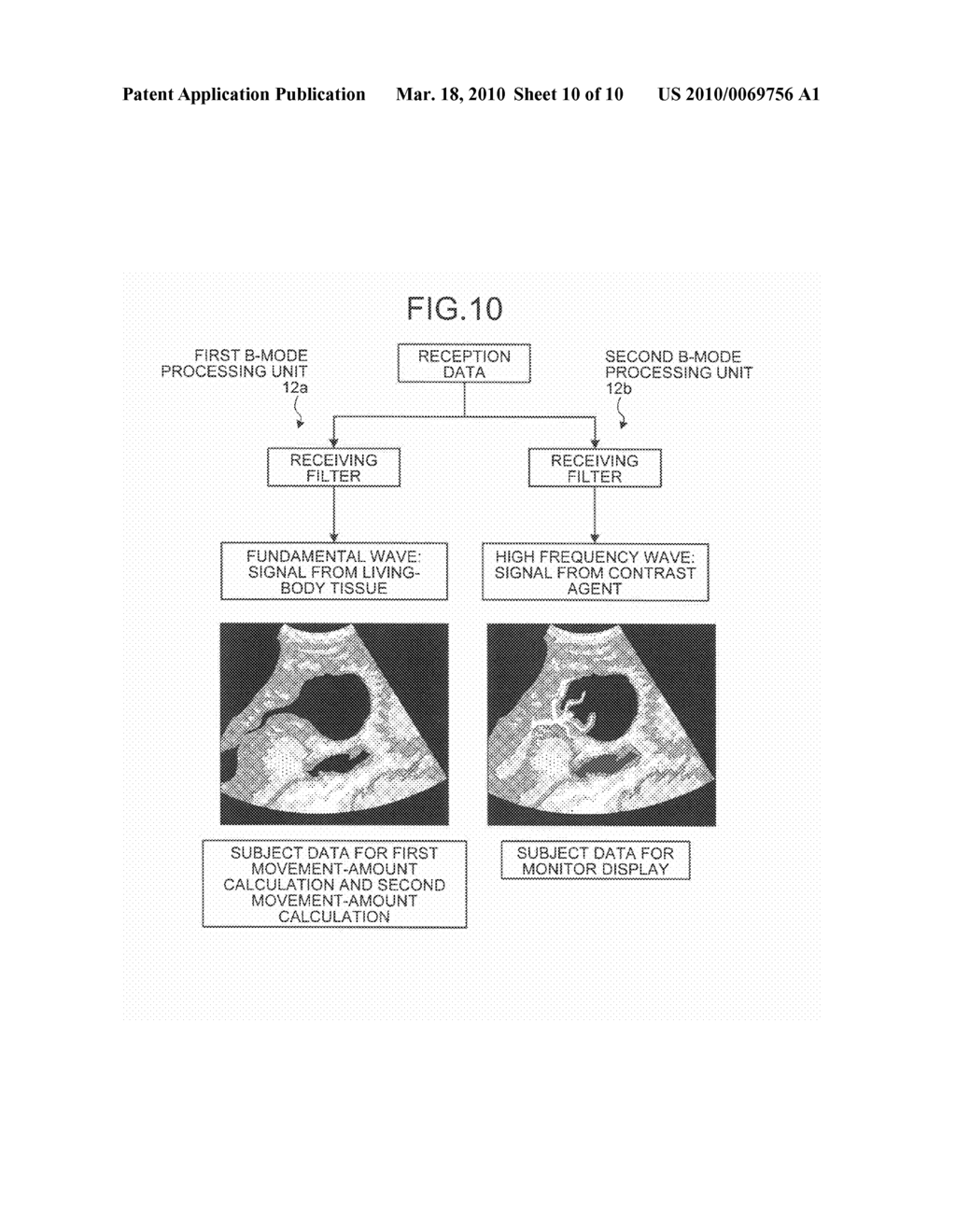 ULTRASONIC DIAGNOSTIC APPARATUS AND COMPUTER PROGRAM PRODUCT - diagram, schematic, and image 11