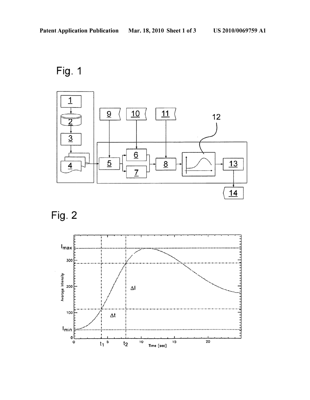 Method for the quantitative display of blood flow - diagram, schematic, and image 02