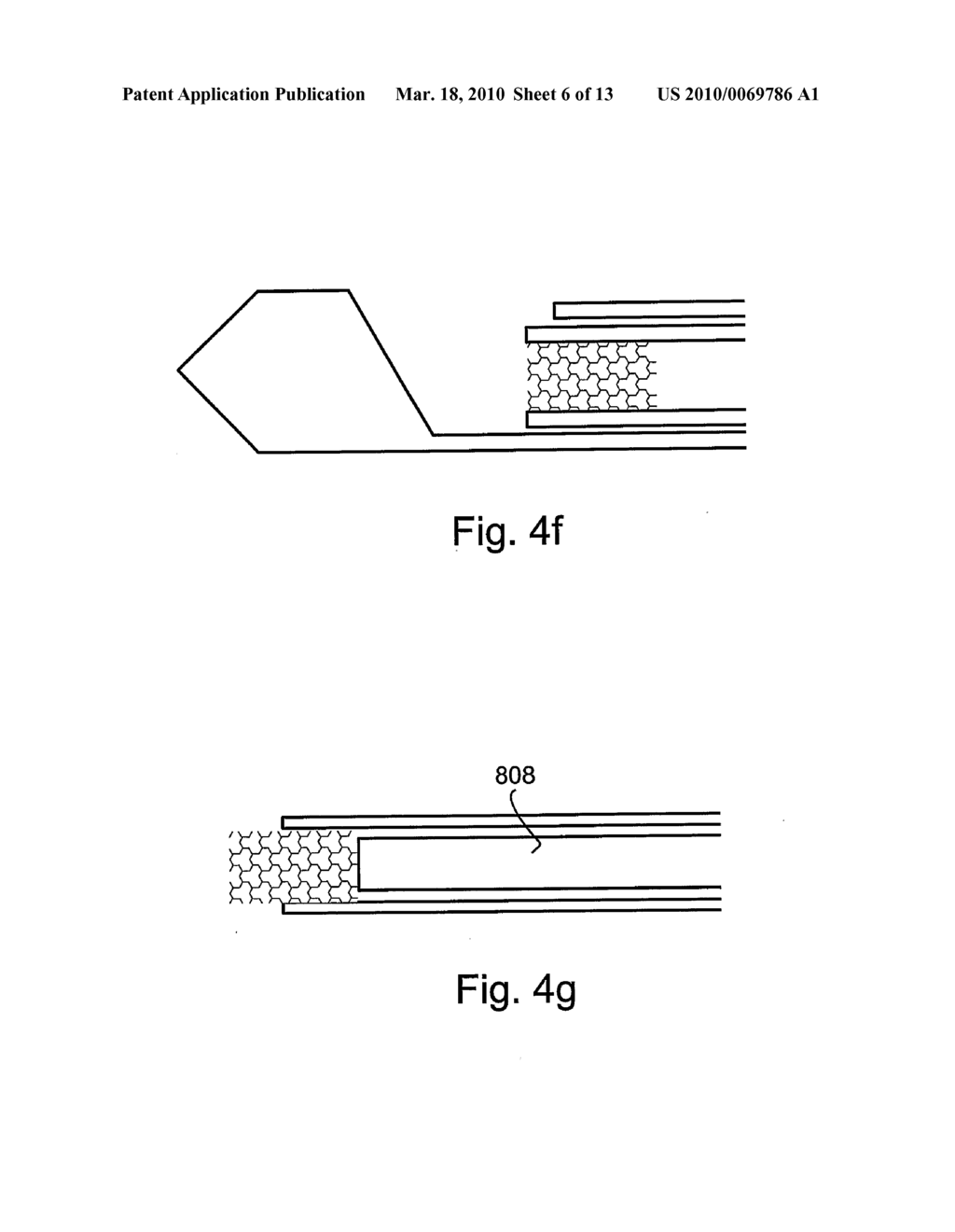 INTEGRATED BONE BIOPSY AND THERAPY APPARATUS - diagram, schematic, and image 07