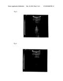 Metal Needle Usable in Echo Imaging diagram and image