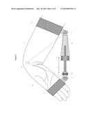 WEARABLE DEVICE TO ASSIST WITH THE MOVEMENT OF LIMBS diagram and image